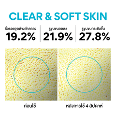 Clear skin set (Retinol cica ampoule 30 ml & Volcanic BHA pore cleansing foam 250 g)